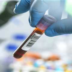 A Progressive Step Forward: NHS Trials Revolutionary Cancer-Detecting Blood Test