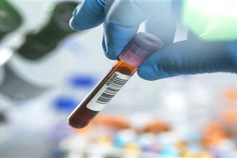 A Progressive Step Forward: NHS Trials Revolutionary Cancer-Detecting Blood Test