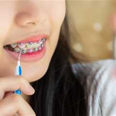 How to Encourage Your Teen to Stick to Their Braces Care Routine in Marietta