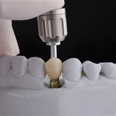 Single Tooth Dental Implants | Edental Perth