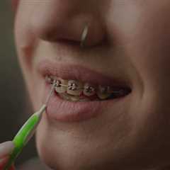 Braces for Athletes: How to Protect Your Smile During Sports