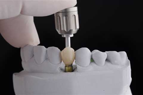 Single Tooth Dental Implants | Edental Perth