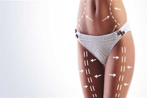 A Combined Approach: Clinical Nutrition And Liposuction For Lasting Results In Scottsdale