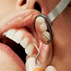 Basel Dentistry: Why Severe Tooth Pain Relief Requires More Than Just Dentistry Tools