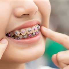 First-Time Guide to Standard Metal Braces for Preteens and Tweens