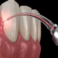 How Laser Dentistry Helps Treat Gum Disease Without Surgery