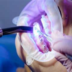 Transform Your Smile with Top-Notch Invisalign Dentists in Fort Walton Beach