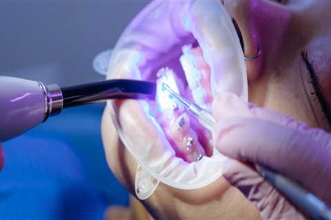 Transform Your Smile with Top-Notch Invisalign Dentists in Fort Walton Beach