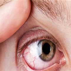 Understanding Common Eye Conditions That Require Specialized Care