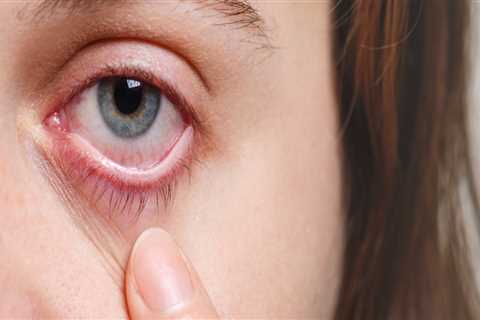 Understanding the Risks of Contact Lens Use and Eye Care Services