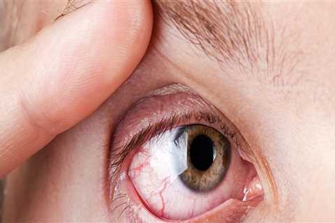 Understanding Common Eye Conditions That Require Specialized Care