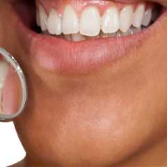 The Impact of Diet on the Frequency of Professional Teeth Cleanings