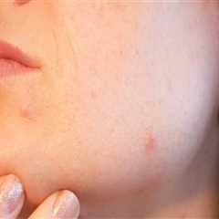 Experience Holistic Wellness at Our Skin Clinic in Hillarys