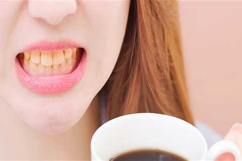 Understanding the Impact of Teeth Cleaning on Coffee and Tea Stains