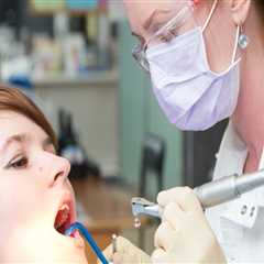 The Hidden Administrative Factors That Affect Access to Routine Teeth Cleaning Services